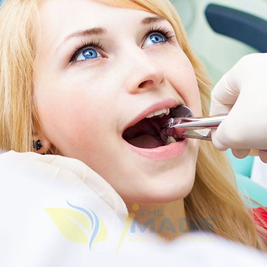 Wisdom Teeth Removal in Hebbal