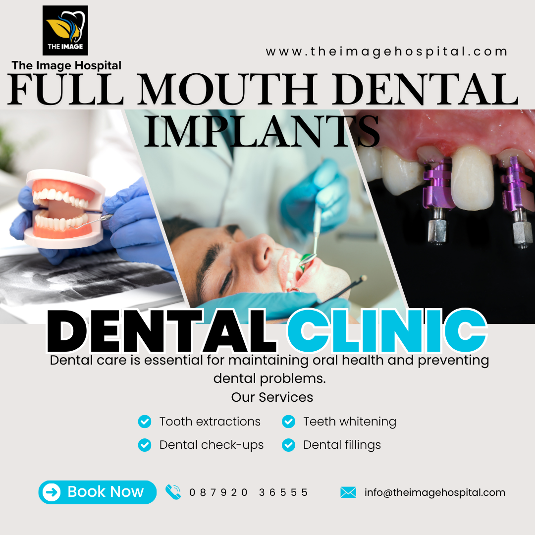 Full Mouth Dental Implants