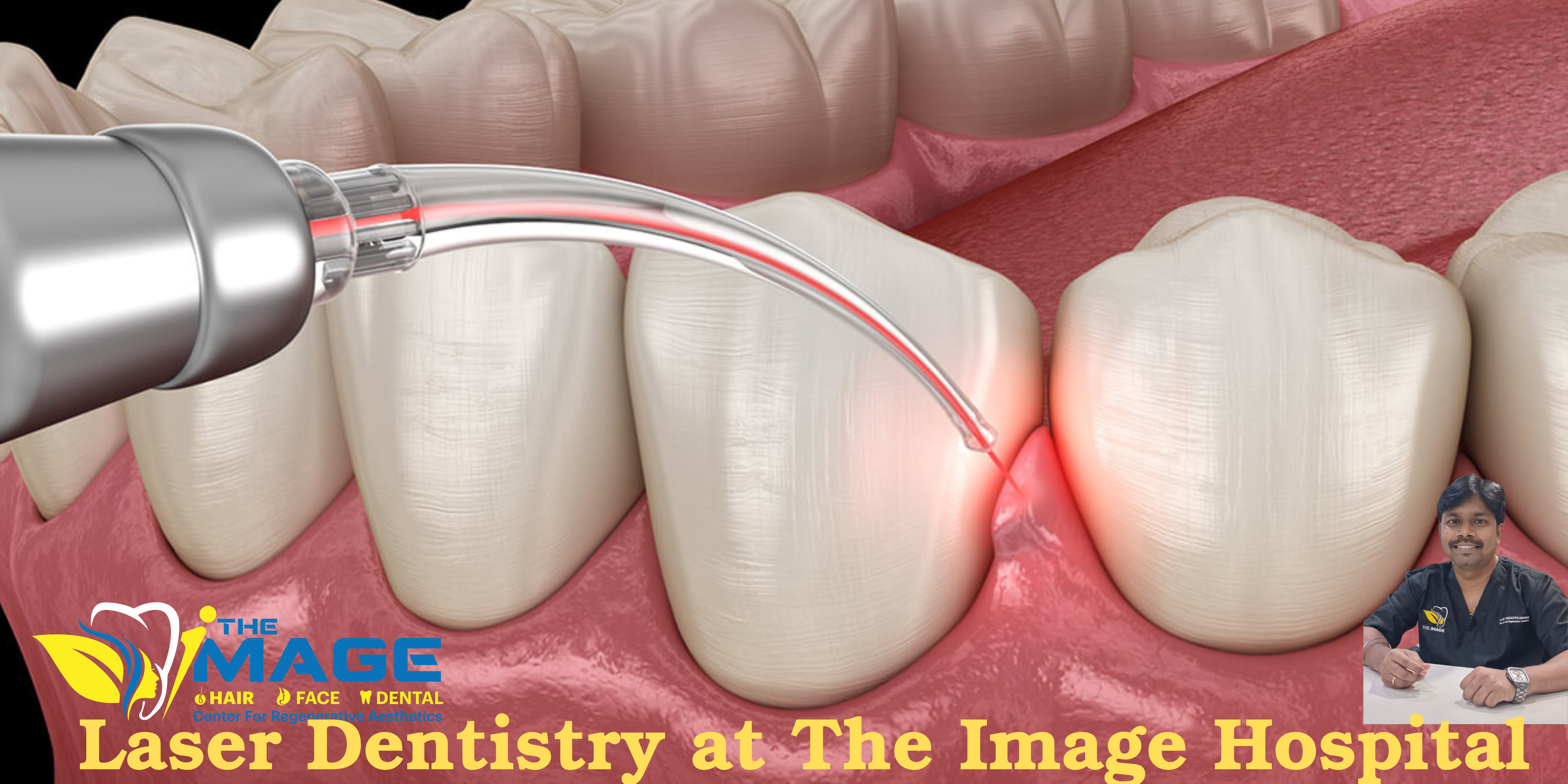 Laser Dentistry