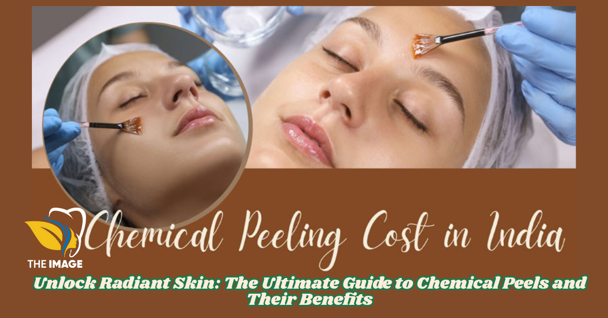 chemical peel treatment in Bangalore