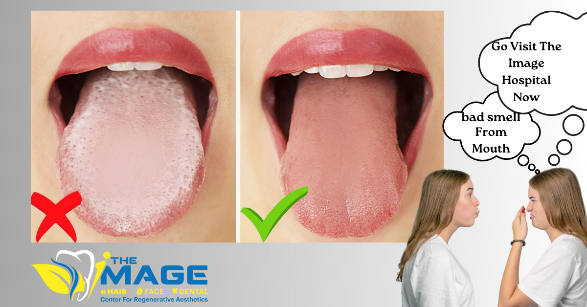 Bad Breath