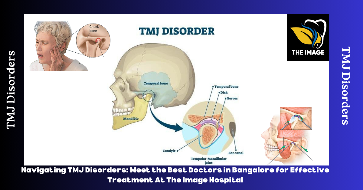 Best Doctors For Tmj Disorders Treatment In Bangalore