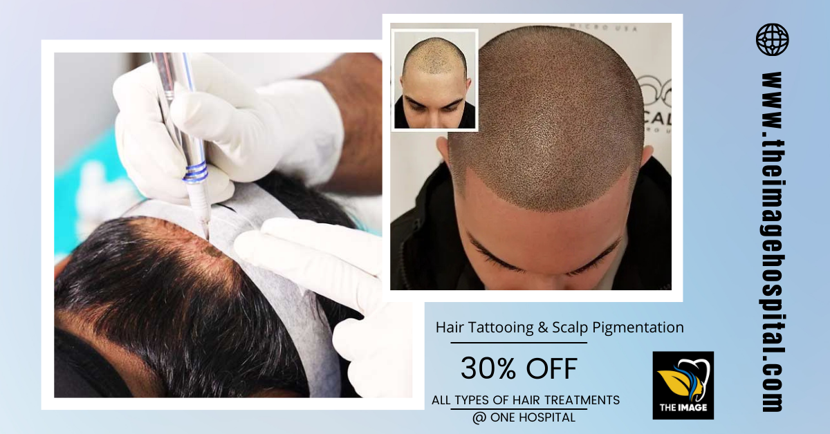 scalp micropigmentation