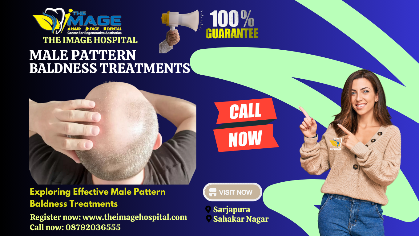 Exploring Effective Male Pattern Baldness Treatments